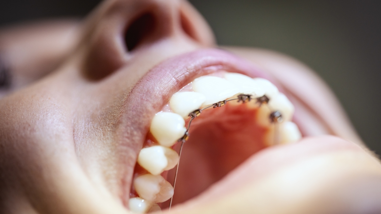 Why do my teeth hurt when I wake up